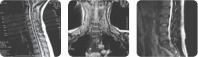 척추신경계 검사 MRI