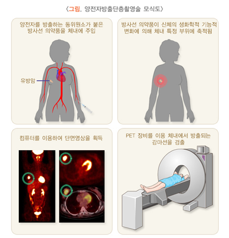 그림, 양전자방출단층촬영술 모식도