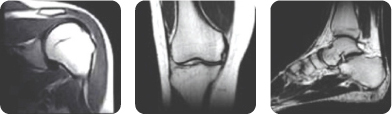 근골격계 검사 MRI