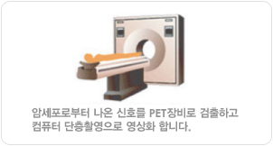 암세포로부터 나온 신호를 PET장비로 검출하고 컴퓨터 단층촬영으로 영상화 합니다.